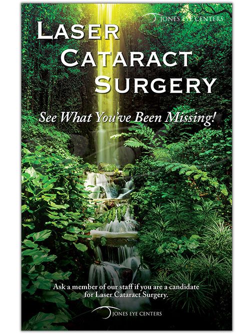 Laser Cataract Surgery Waterfall Poster Patient Education Concepts