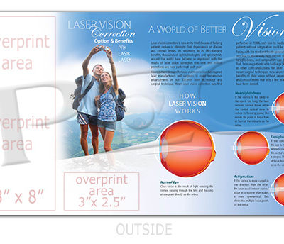 Laser Vision Correction, Options & Benefits Brochure
