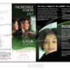 iLASIK - Incredible Vision Brochure