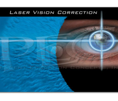 Target Laser Vision Correction Post Card