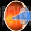 A World of Better Vision Video