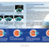 Discover the World of LASIK Brochure