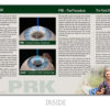 PRK Brochure