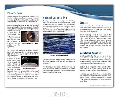 Corneal Crosslinking Brochure