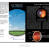 Eye Floaters Treatment Brochure